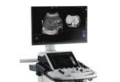 LOGIQ P8 general imaging ultrasound 1