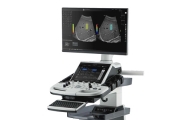 LOGIQ P10 general imaging ultrasound 3