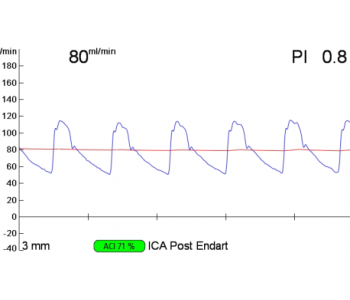 cea-pre-and-post-3-e1453286656362