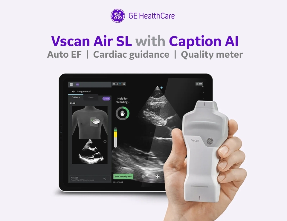 captionai mobile 