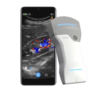 Vscan Air handheld Ultrasound Hong Kong 1