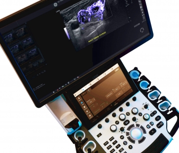 LOGIQ Fortis general imaging ultrasound